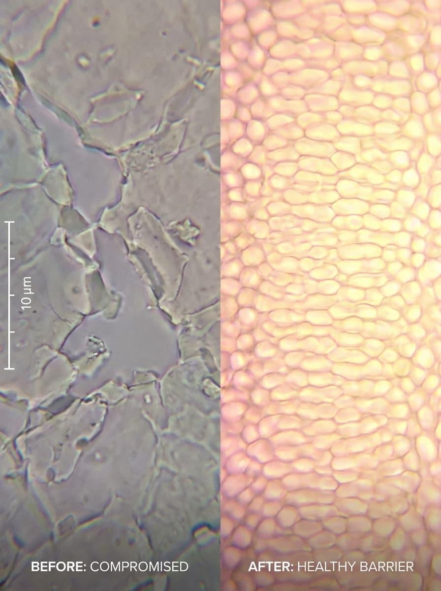 스킨케어 Before & After 04